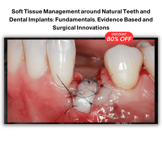 Soft Tissue Management around Natural Teeth and Dental Implants: Fundamentals, Evidence Based and Surgical Innovations