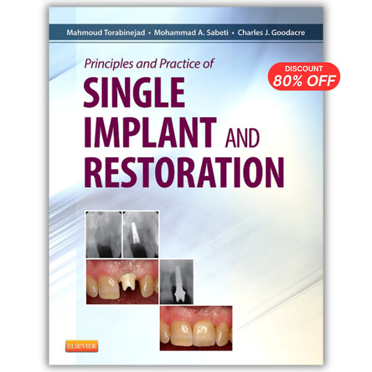 Principles and Practice of Single Implant and Restorations