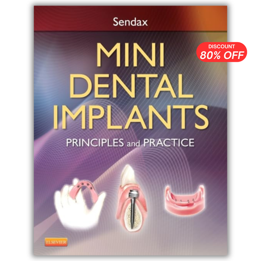 Mini Dental Implants: Principles and Practice
