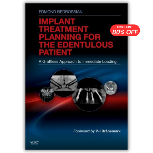Implant Treatment Planning for the Edentulous Patient: A Graftless Approach to Immediate Loading