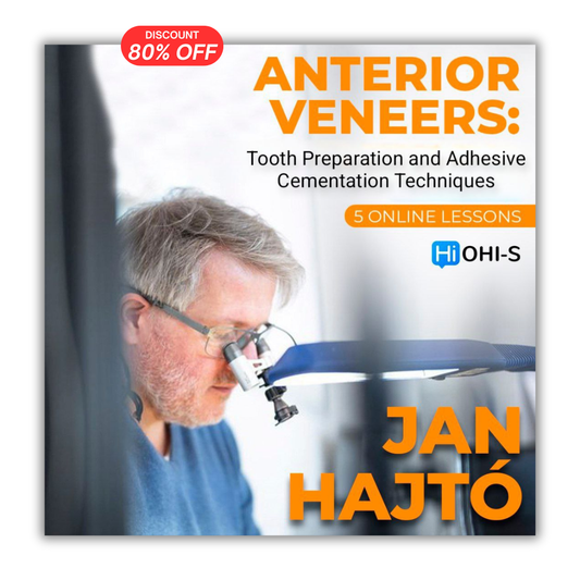 Anterior Veneer: Tooth Preparation and Adhesive Cementation Techniques