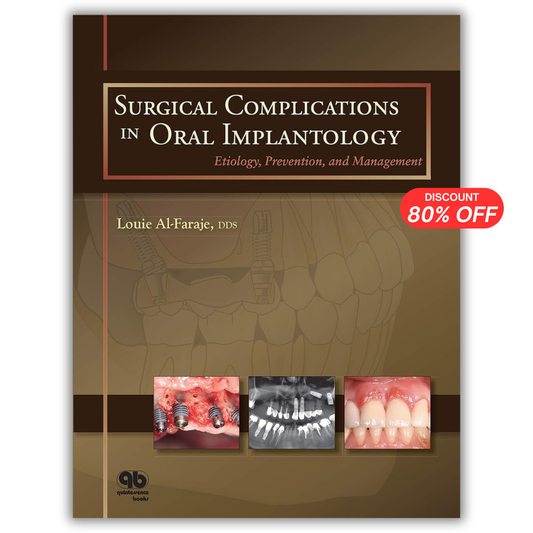 Surgical Complications in Oral Implantology: Etiology, Prevention, and Management
