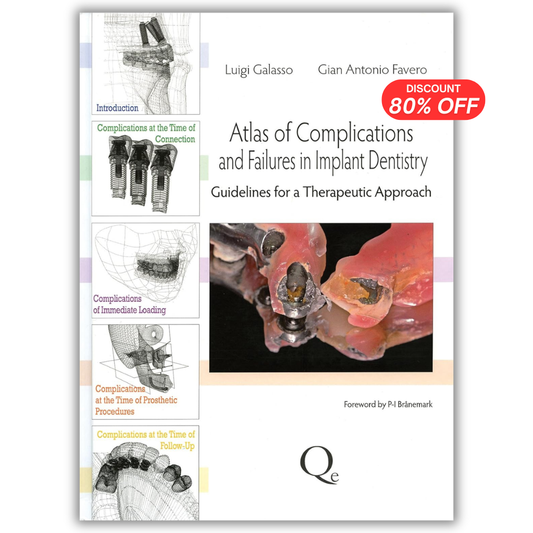 Atlas of Complications and Failures in Implant Dentistry: Guidelines for a Therapeutic Approach