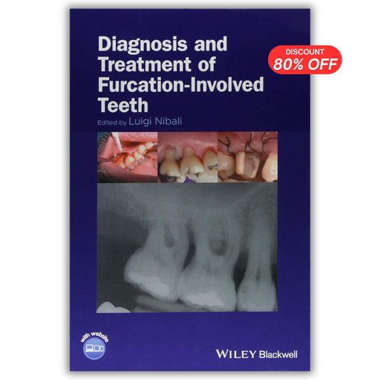 Diagnosis and Treatment of Furcation‐Involved Teeth