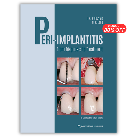Peri-Implantitis: From Diagnosis to Treatment (PDF)