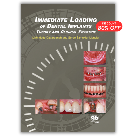 Immediate Loading of Dental Implants: Theory and Clinical Practice