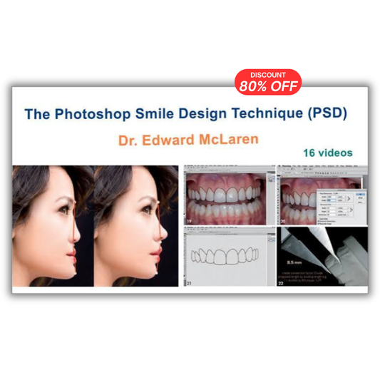 The Photoshop Smile Design Technique (PSD)
