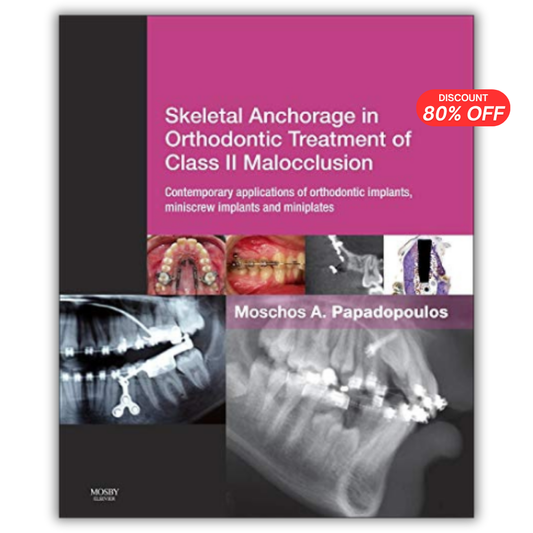 Skeletal Anchorage in Orthodontic Treatment of Class II Malocclusion (PDF)