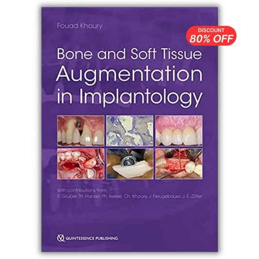 Bone and Soft Tissue Augmentation in Implantology 1st Edition