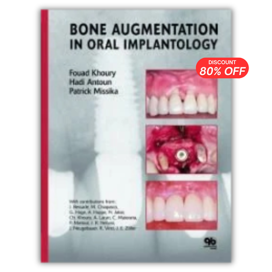 Bone Augmentation in Oral Implantology