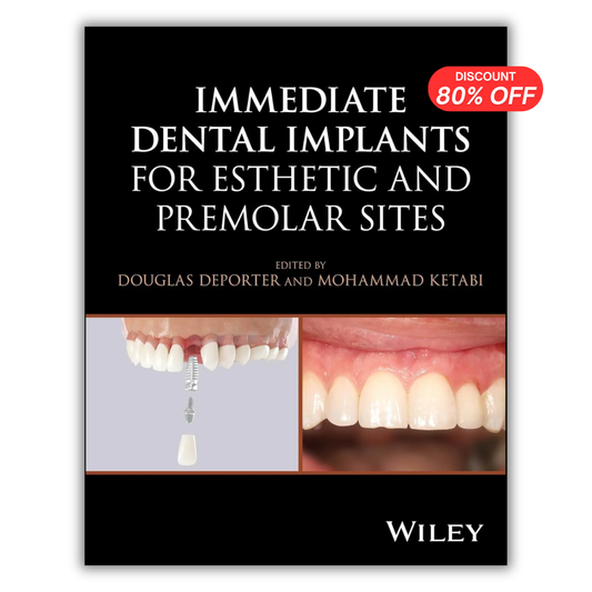 Immediate Dental Implants for Esthetic and Premolar Sites 1st Edition