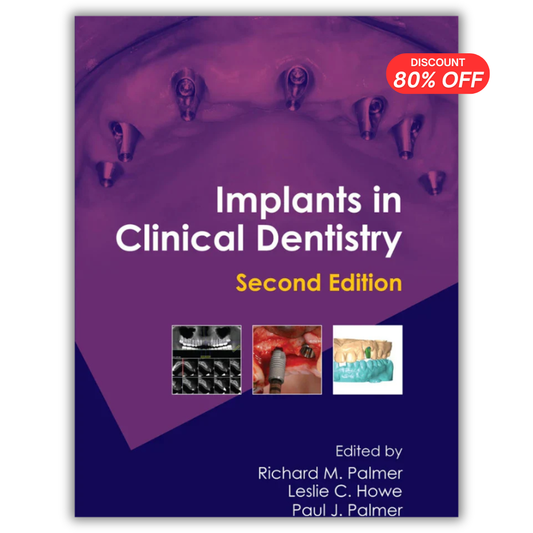 Implants in Clinical Dentistry, 2nd Edition