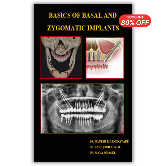 Basics of Basal and Zygomatic Implants