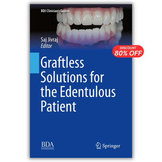 Graftless Solutions for the Edentulous Patient