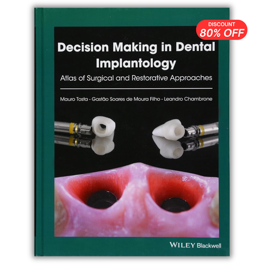 Decision Making in Dental Implantology: Atlas of Surgical and Restorative Approaches