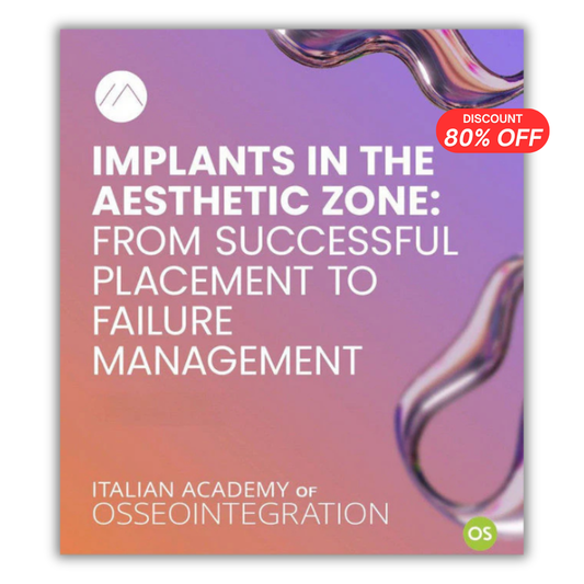 Implants in the Aesthetic Zone: From Successful Placement to Failure Management