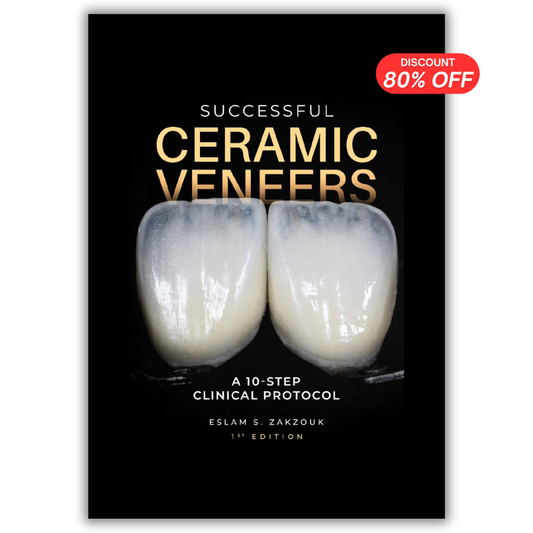 Successful Ceramic Veneers: 10 Steps Clinical Protocol  (PDF)