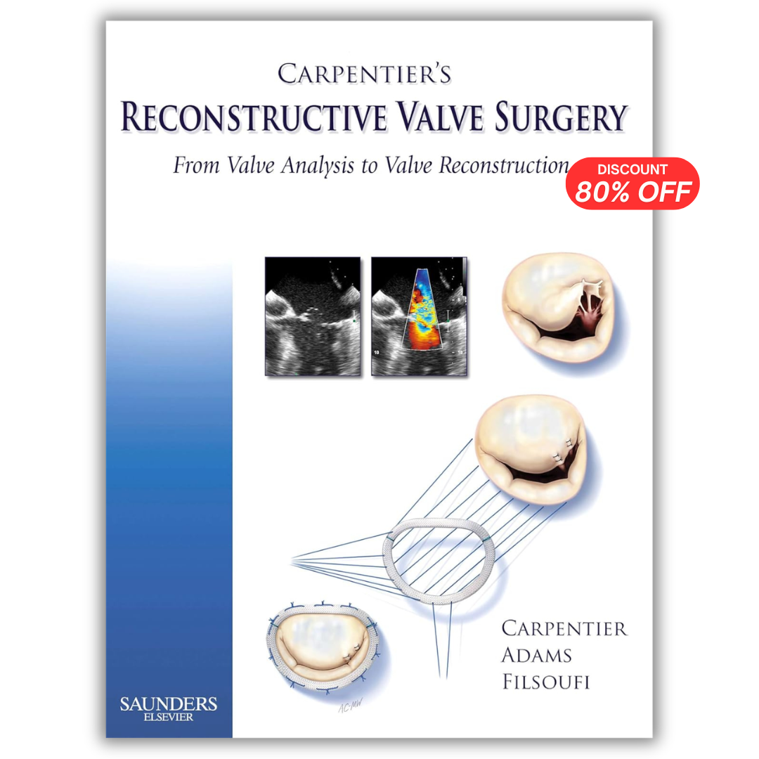 Carpentier’s Reconstructive Valve Surgery, 1e (PDF)