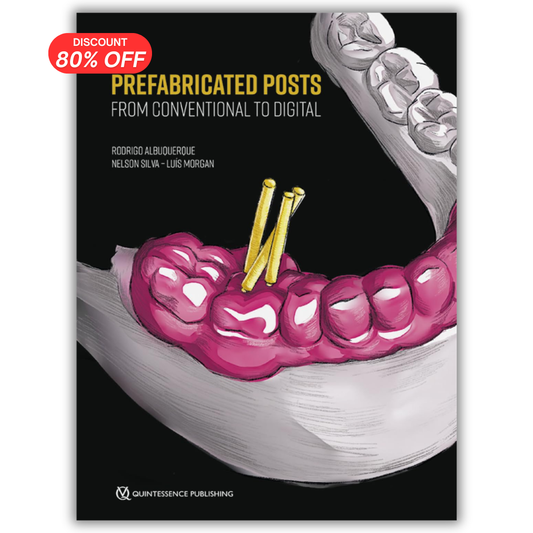 Prefabricated Posts: From Conventional to Digital PDF