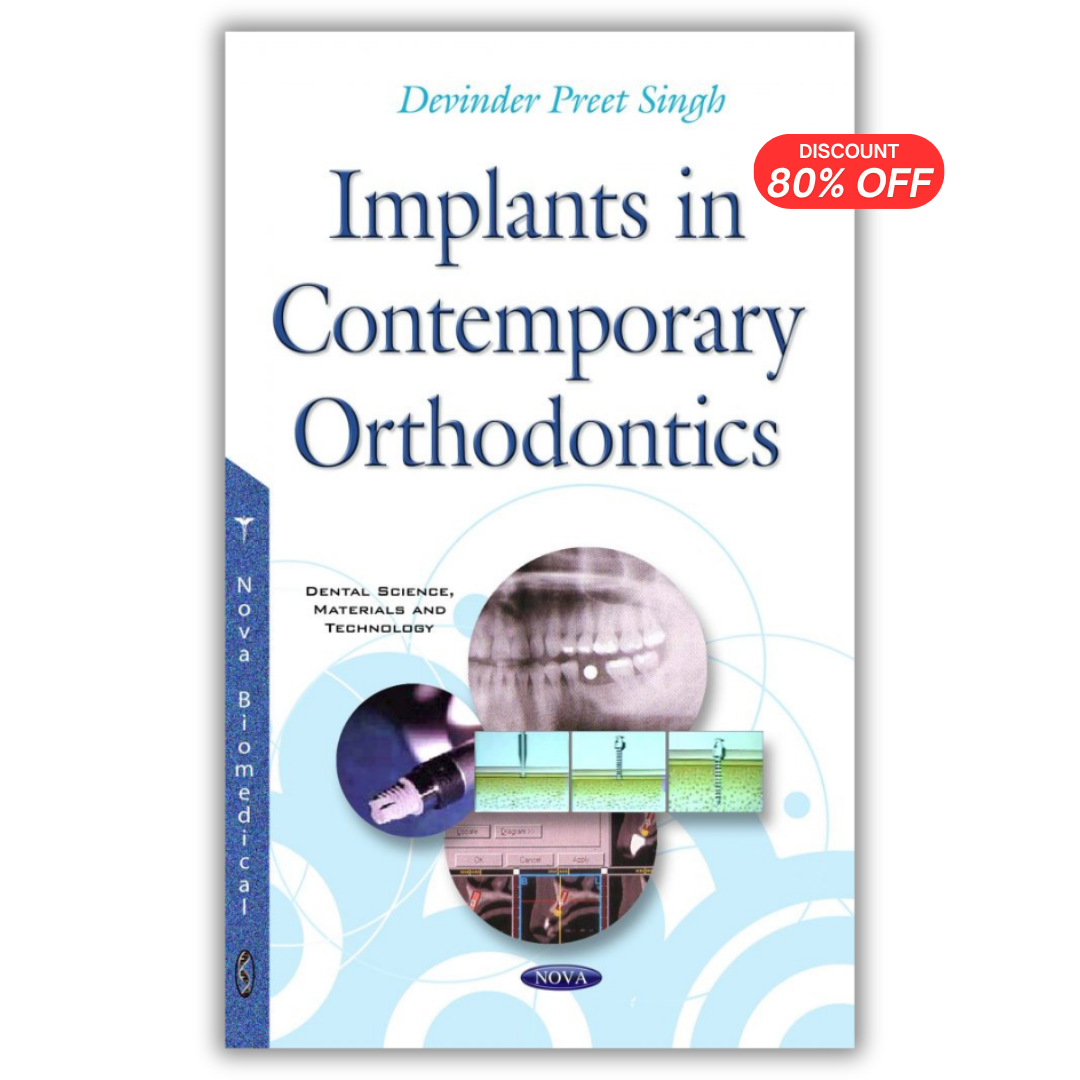 Implants in Contemporary Orthodontics
