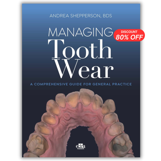 Managing Tooth Wear. A Comprehensive Guide For General Practice PDF