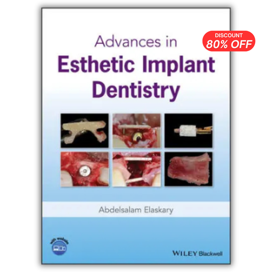 Advances in Esthetic Implant Dentistry