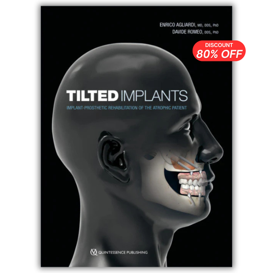 Tilted Implants: Implant-Prosthetic Rehabilitation of the Atrophic Patient (Scanned Copy)