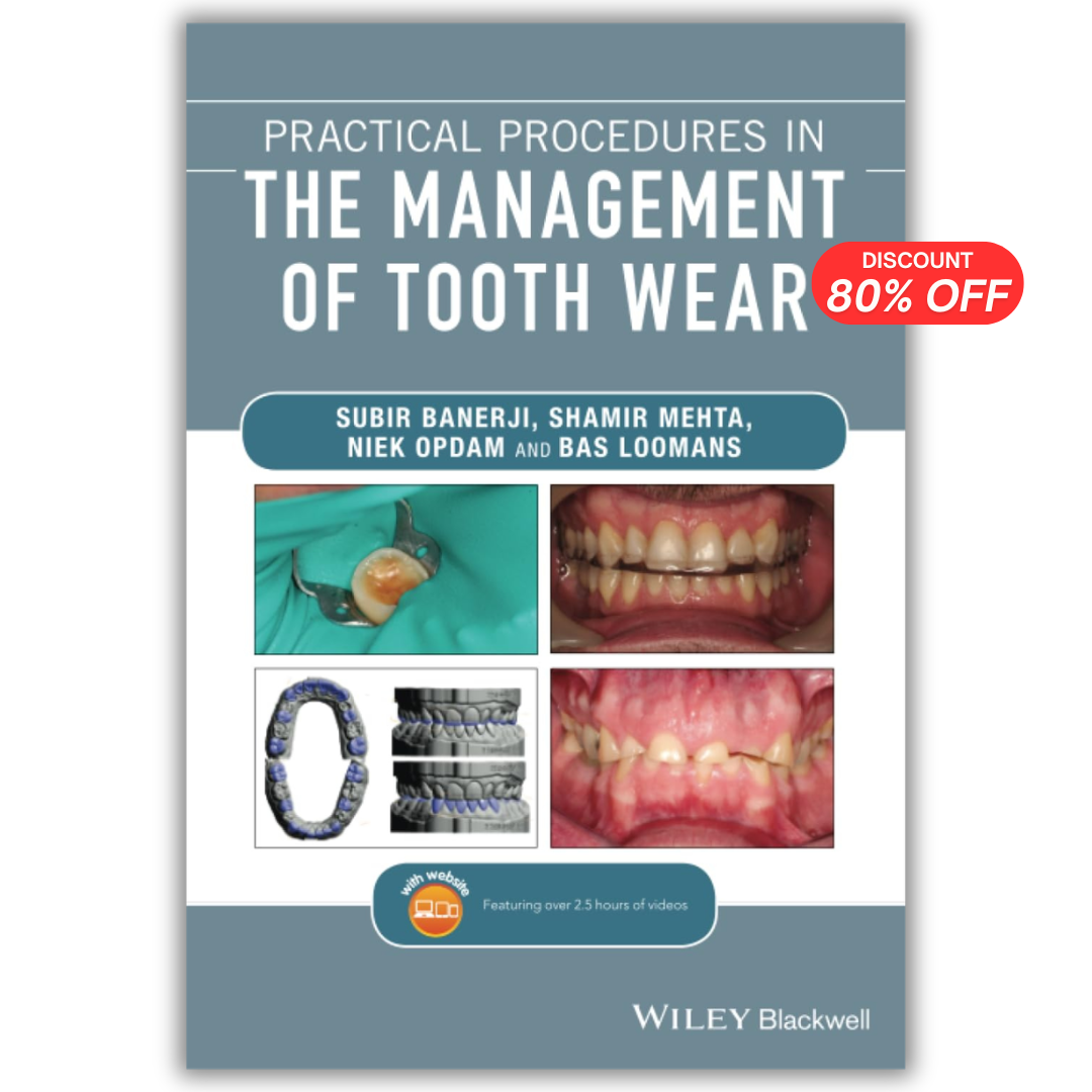 Practical Procedures in the Management of Tooth Wear (PDF)