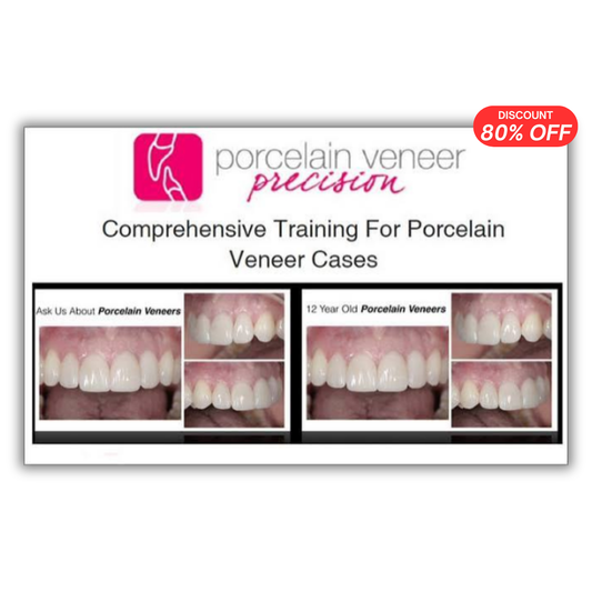 Porcelain Veneer Precision: Comprehensive Training for Porcelain Veneer Cases