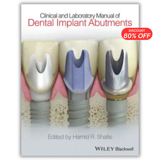 Clinical and Laboratory Manual of Dental Implant Abutments PDF