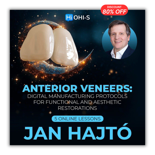 Anterior Veneers: Digital Manufacturing Protocols for Functional and Aesthetic Restorations