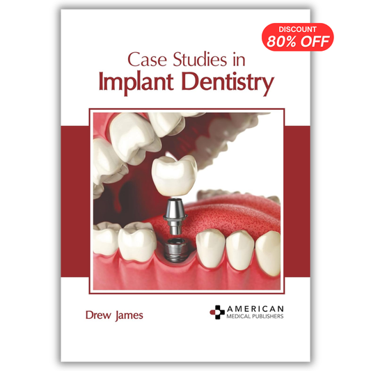 Case Studies in Implant Dentistry