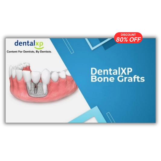 Vertical & Horizontal Bone Grafts (238 Lectues Collection)