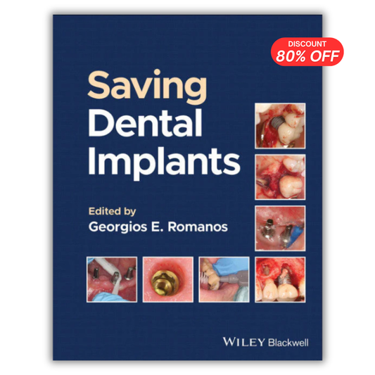 Saving Dental Implants