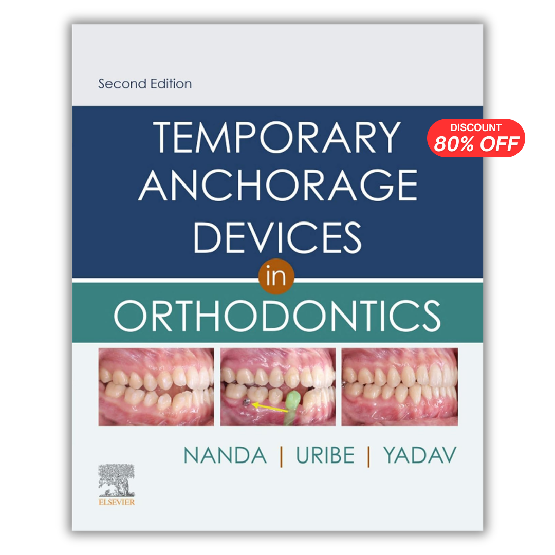Temporary Anchorage Devices in Orthodontics, 2ed (PDF)