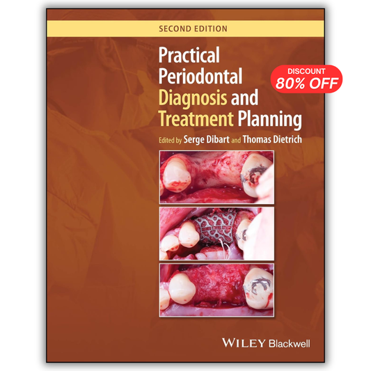 Practical Periodontal Diagnosis and Treatment Planning, 2nd Edition