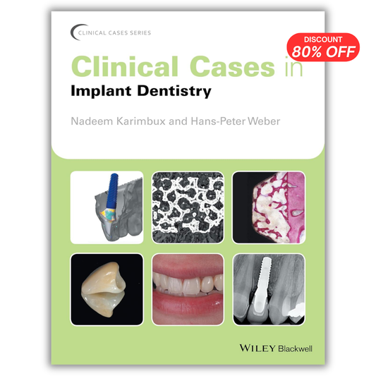 Clinical Cases in Implant Dentistry