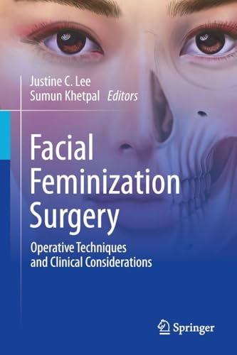 Springer Facial Feminization Surgery Textbook Publisher PDF