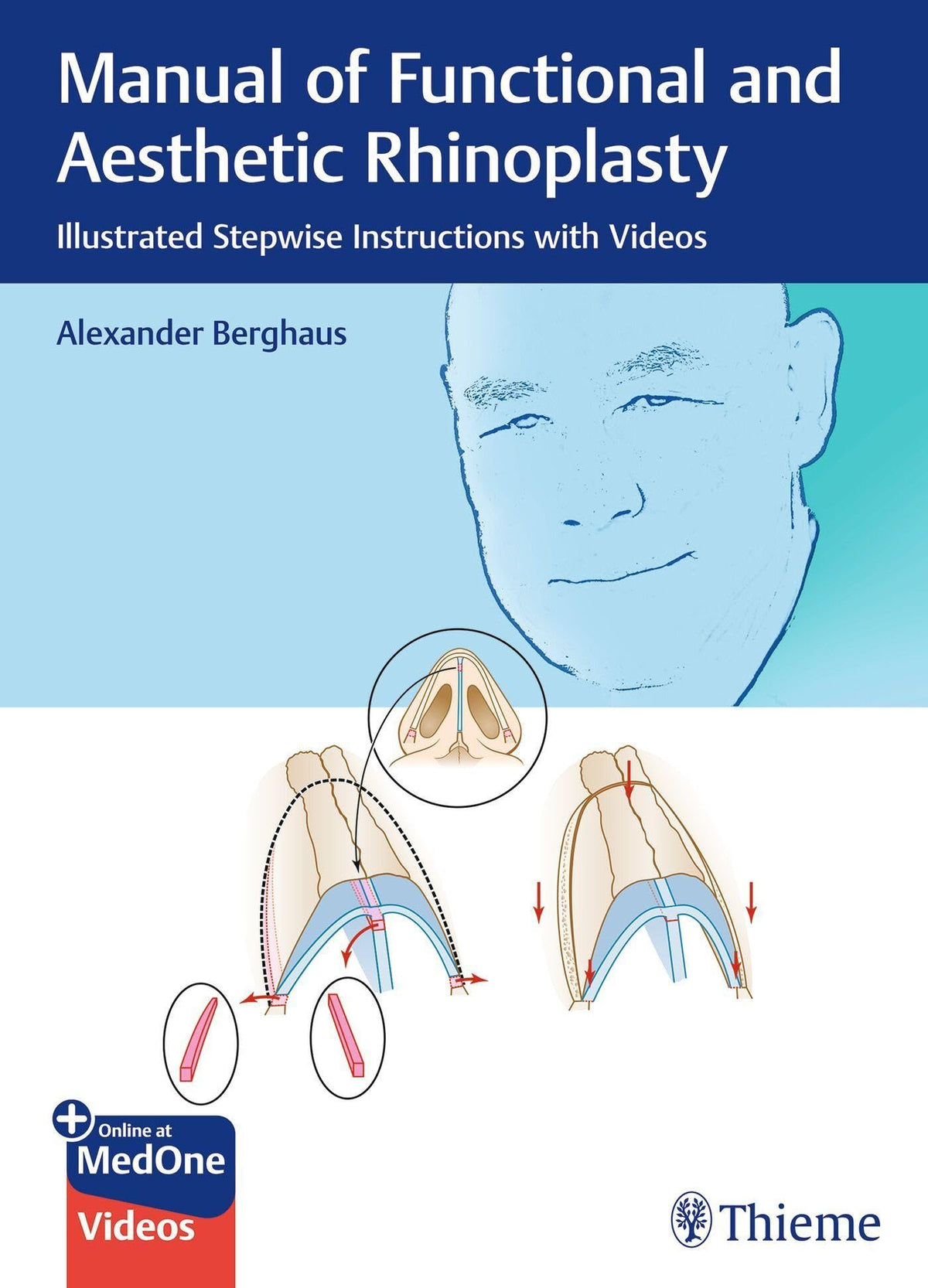 Manual of Functional and Aesthetic Rhinoplasty by Alexander Berghaus