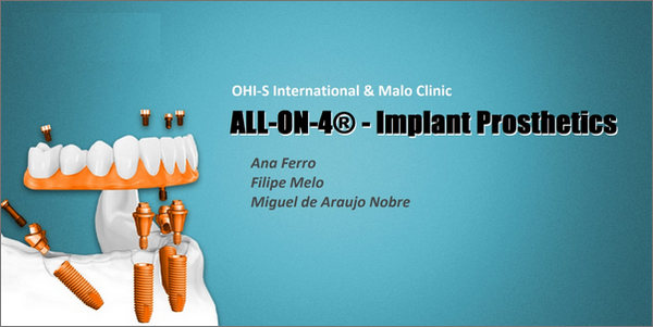 https://dentalmp4.com/wp-content/uploads/2023/01/ALL-ON-4-Implant-Prosthetics.jpg