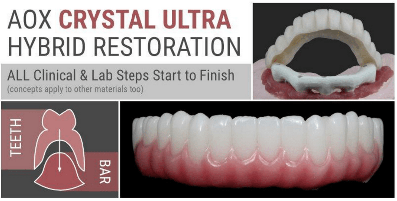 https://dentalmp4.com/wp-content/uploads/2024/10/AOX-Crystal-Ultra-Hybrid-Restoration.png