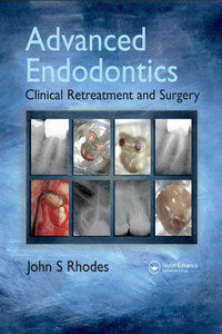 https://www.dentalbooks.org/wp-content/uploads/2019/02/Advanced-Endodontics-Clinical-Retreatment-and-Surgery.jpg