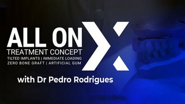 https://dentalmp4.com/wp-content/uploads/2023/03/All-On-X-treatment-concept.jpg