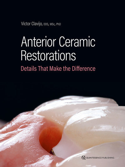 https://dentalmp4.com/wp-content/uploads/2025/12/Anterior-Ceramic-Restorations.jpg
