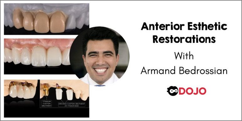 https://dentalmp4.com/wp-content/uploads/2024/05/Anterior-Implant-Esthetic-Restorations.jpg