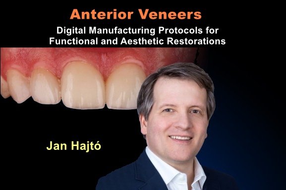https://dentalmp4.com/wp-content/uploads/2023/12/Anterior-Veneers_Digital-Manufacturing-Protocols-for-Functional-and-Aesthetic-Restorations.jpg