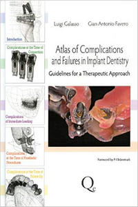https://www.dentalbooks.org/wp-content/uploads/2019/02/Atlas-of-Complications-and-Failures-in-Implant-Dentistry.jpg