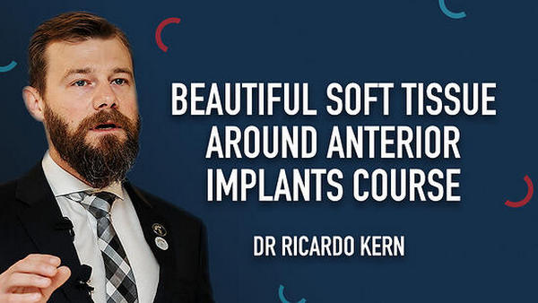 https://dentalmp4.com/wp-content/uploads/2022/12/Beautiful-Soft-Tissue-Around-Anterior-Implants.jpg