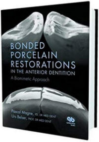https://www.dentalbooks.org/wp-content/uploads/2019/02/Bonded-Porcelain-Restorations-in-the-Anterior-Dentition-200x286.jpg
