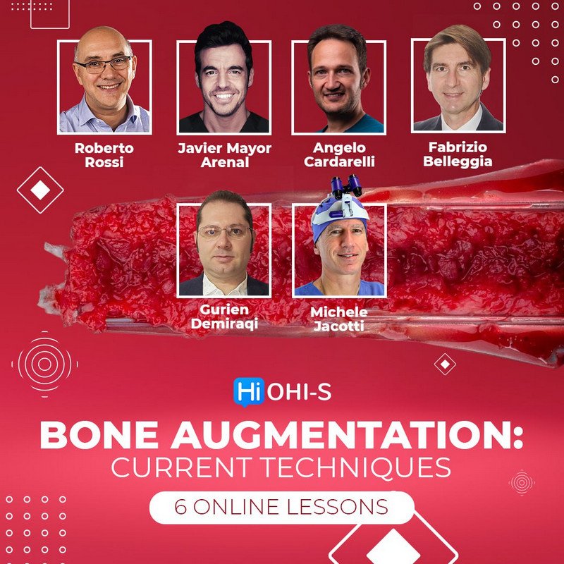 https://dentalmp4.com/wp-content/uploads/2024/04/Bone-Augmentation-Current-Techniques.jpg